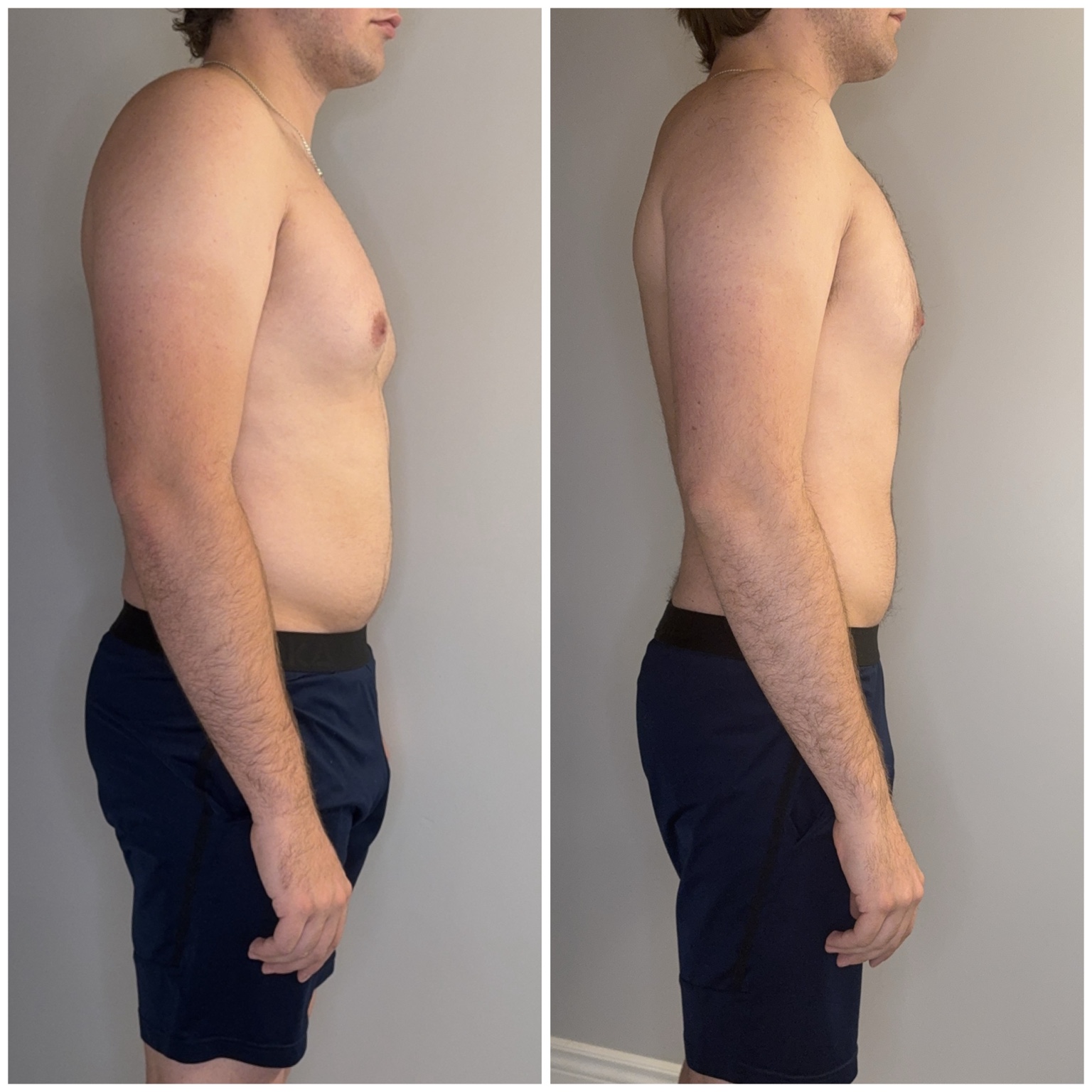 Client progress photos, gallery image 24